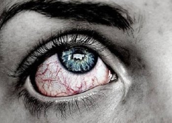 Koronavirüs belirtileri gözlerde de tespit edildi.